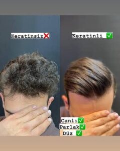 keratin